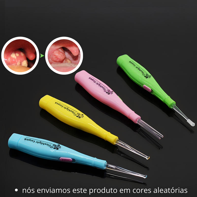 PROMOÇÃO PAGUE 1 LEVE 3 + BRINDE - KIT REMOVEDOR DE CÁSEOS
