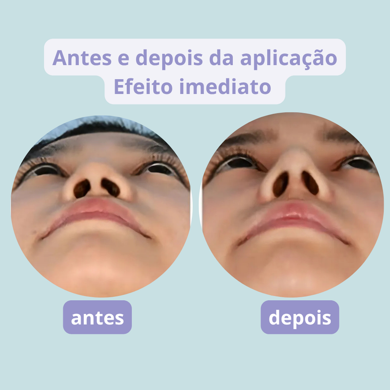 NARIFIT - Modelador de Nariz Sem Cirurgia com Efeito Imediato
